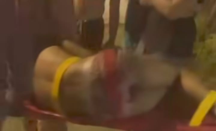 Baleado durante troca de tiros com a GCM, assaltante está internado em Jundiaí